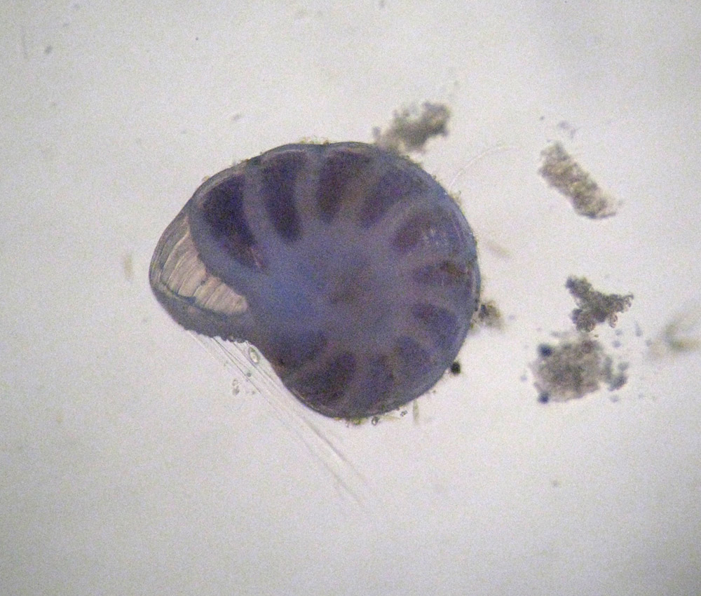 Direi Hyalinea balthica (Foraminifera)